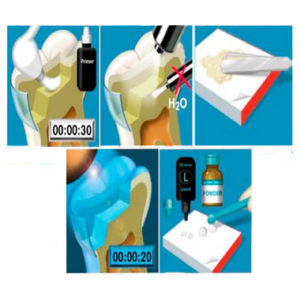 Vitremer en estuche pequeño en color A3, ionomero de restauraciones temporales. Deposito Dentalmex Tienda Online