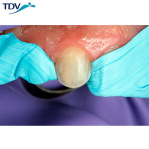 Isotape de la marca TDV. Deposito Dental Dentalmex Online