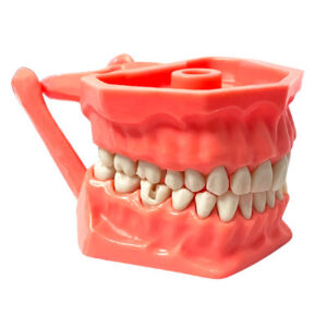 Tipodonto con cavidades. Deposito Dentalmex